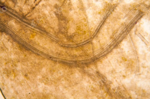 Preview: Microscopic View And Details Of Rotten Tulip Stem