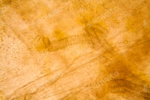 Preview: Microscopic View And Details Of Rotten Tulip Stem