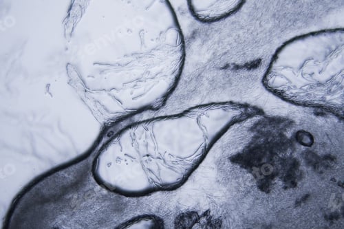Preview: Mold At The Microscope
