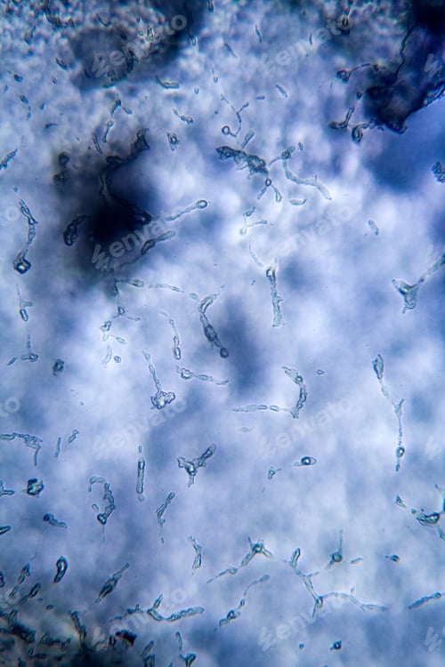 Preview: Mold At The Microscope