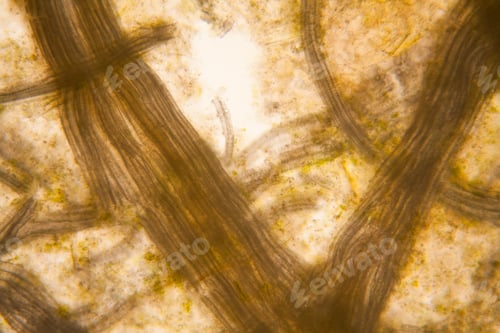 Preview: Microscopic View And Details Of Rotten Tulip Stem