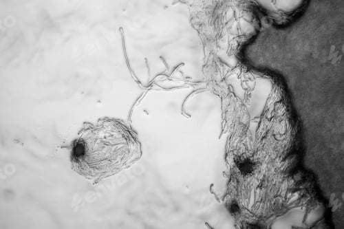 Preview: Mold At The Microscope