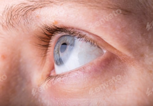 Preview: Eye In Close Up