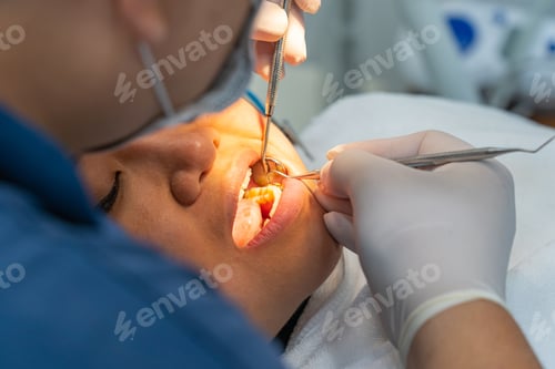 Preview: Dentist Using Dental Probe And Scaler For Checking Up Patient'S Teeth