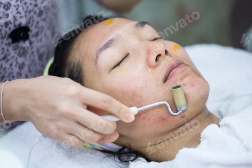 Preview: Beauty Treatment Of Face Skin By Balance Ion For Spot Remover In Spa Center. Acne Treament.