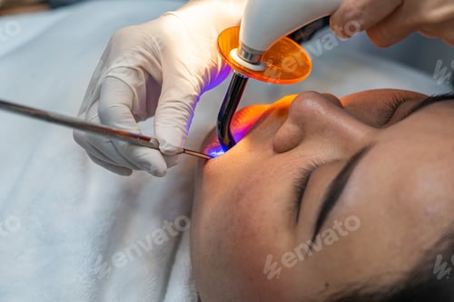 Preview: Close Up Photo Of Asian Woman Having Dental Ultraviolet Light Treatment