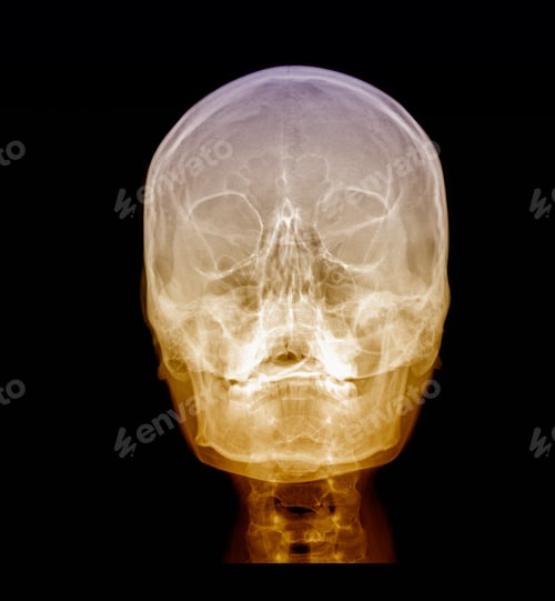 Preview: Front View Of Human Brain X-Ray Medical Scan.