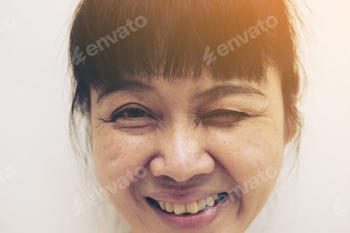 Preview: Woman Checking Wrinkles On Her Face And Eyes.