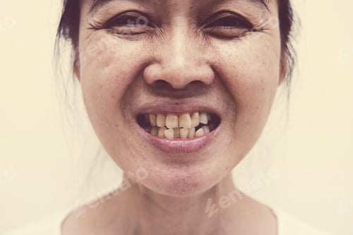 Preview: Blurry Of Women With Unattractive Yellow And Rotten Teeth - See More Dentist Related Pictures