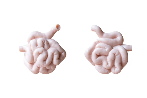 Preview: Human Small Intestine Anatomical Model Isolated On White Background
