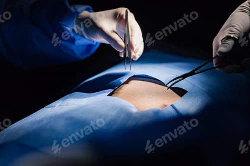 Preview: Surgical Tools Used in Operating Room