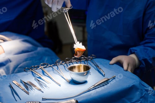 Preview: Surgeon Performing Operation In Operating Room