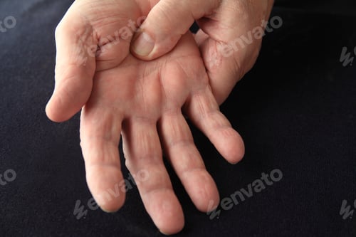 Preview: Closeup Of Older Man With Painful Palm On Black Background