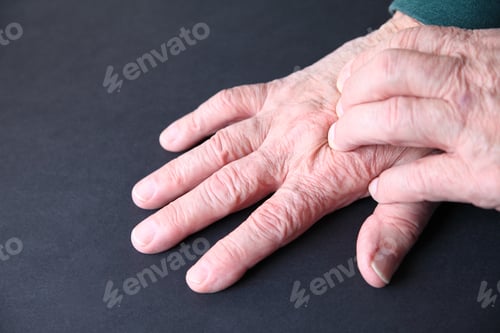 Preview: Older Man Presses His Fingers Onto The Top Of A Hand