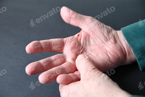 Preview: Senior Man With A Sore Hand On A Dark Gray Background
