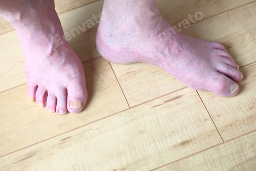 Preview: An Older Man With Bare Feet On The Floor
