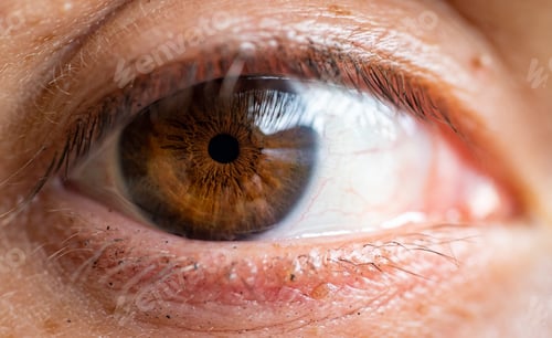 Preview: Brown Human Eye With Small Pupil Due To Outdoor Light On Partly Cloudy Day