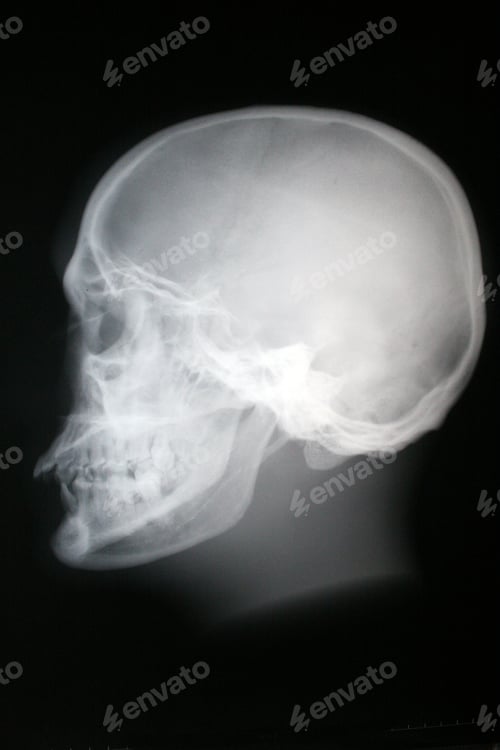 Preview: X-Ray Phantom Head (Face)