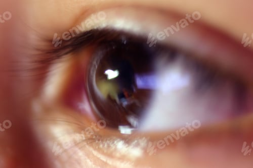 Preview: Extream Closeup Of A Childs Eye