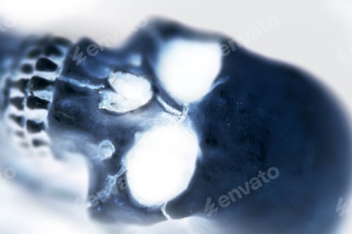 Preview: Abstraction "X-Ray Of A Skull"