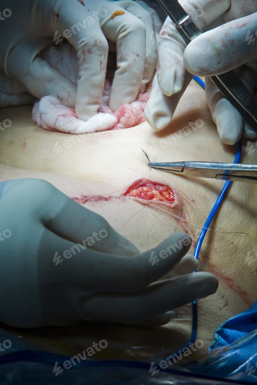 Preview: Close Up Of Doctors Hands Stiching
