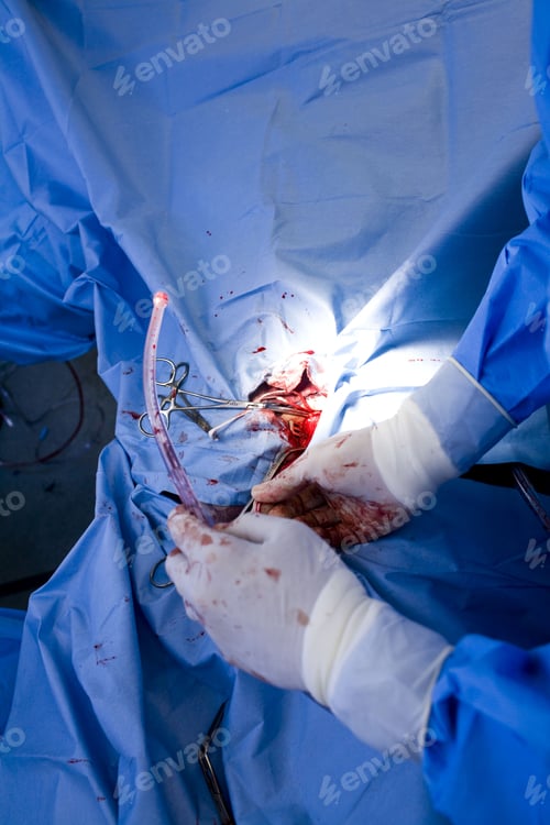 Preview: Details Of A Surgery