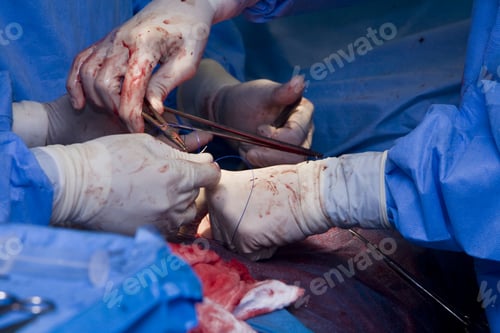 Preview: Close Up Of Medical Team In A Surgery