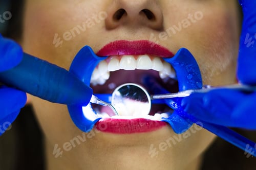 Preview: Periodic Comprehensive Dental Examination To Have A Healthy Mouth And Teeth