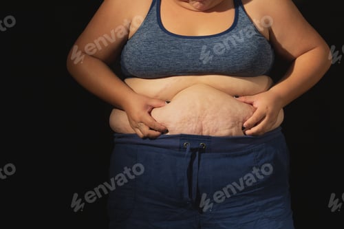 Preview: Woman'S Hand Holding Excessive Belly Fat