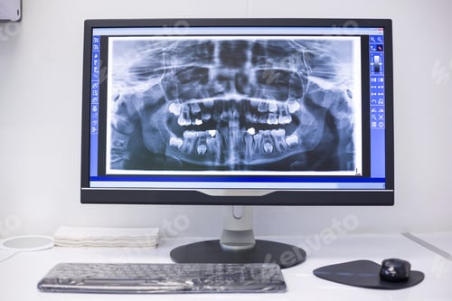 Preview: An X-Ray On The Monitor At Dental Clinic