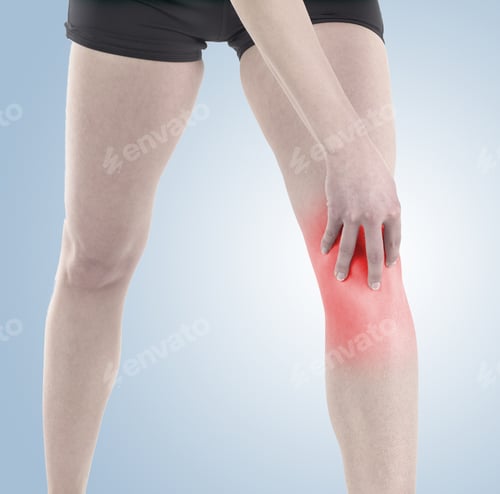 Preview: Acute Pain In A Knee. Woman Holding Hand To Spot Of Knee-Aches.