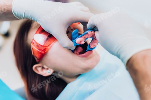 Preview: Doctor Performs The Procedure For Cleaning Teeth