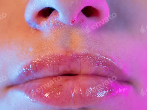 Preview: Beautiful Female Lips And Part Of Nose Cracked From Frost, Wind, Lack Of Vitamins. Herpes Virus