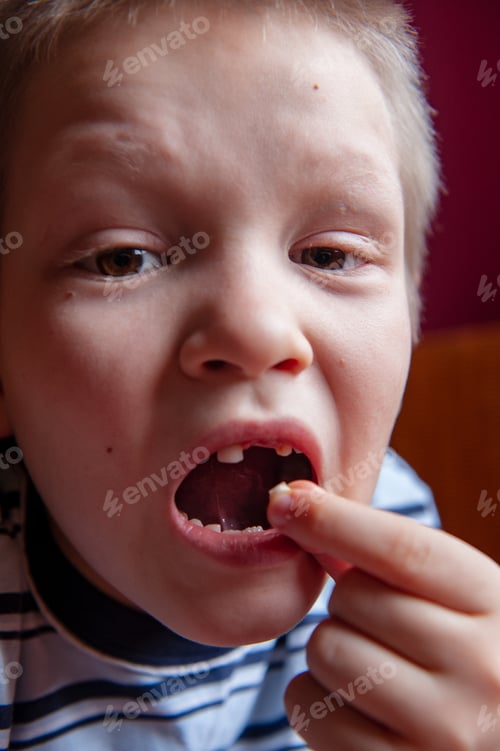 Preview: Cute Baby Shows Dropped Baby Tooth. Boy Smiles With Toothless Mouth. Striped Home Pajamas, Proton