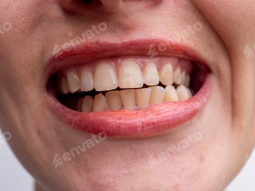 Preview: Middle Aged Woman Laughs On White Background Showing Perfect White Teeth