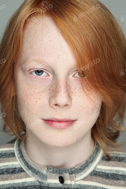 Preview: Close-Up Portrait Of Handsome Redhead Freckled Teen Boy