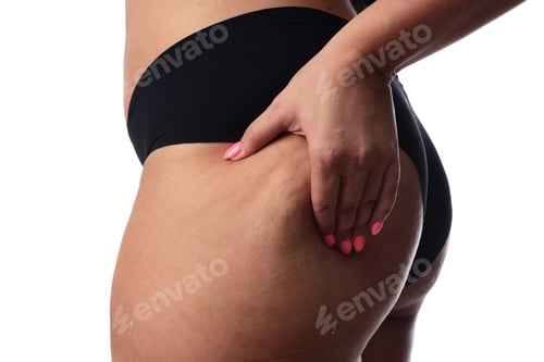 Preview: Young Woman Showing Her Body Fat, Close Up