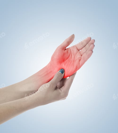 Preview: Human Palm Pain With An Anatomy Injury Caused By Sports Accident Or Arthritis As A Skeletal Joint