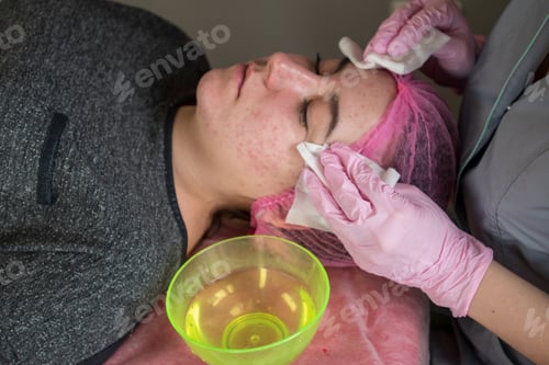 Preview: Doctor Cosmetologist Makes Rejuvenating Facial Injections Procedure For Tightening And Smoothing