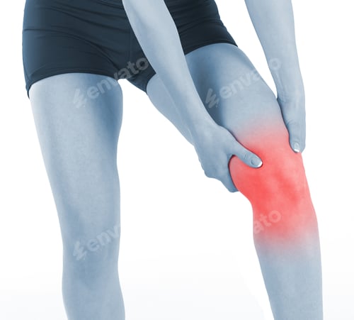 Preview: Acute Pain In A Knee. Woman Holding Hand To Spot Of Knee-Aches.