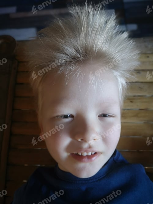 Preview: Handsome Blond Caucasian Boy With Pensive Blue Eyes Smiles In Front Of Camera. Long White Hair