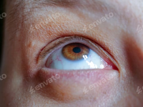 Preview: Macro Shoot Eye Disease, Green-Brown Human Eye Closeup. 35 Year Old Woman