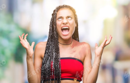 Preview: Young Braided Hair African American With Pigmentation Blemish Birth Mark Over Isolated Background