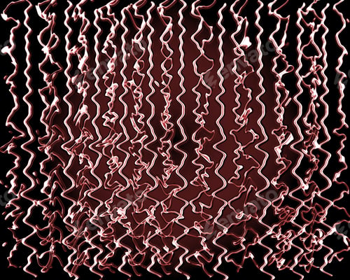 Preview: Abstract Background