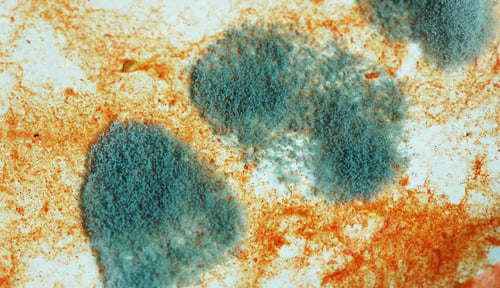 Preview: Fungal Growth On Food Dish