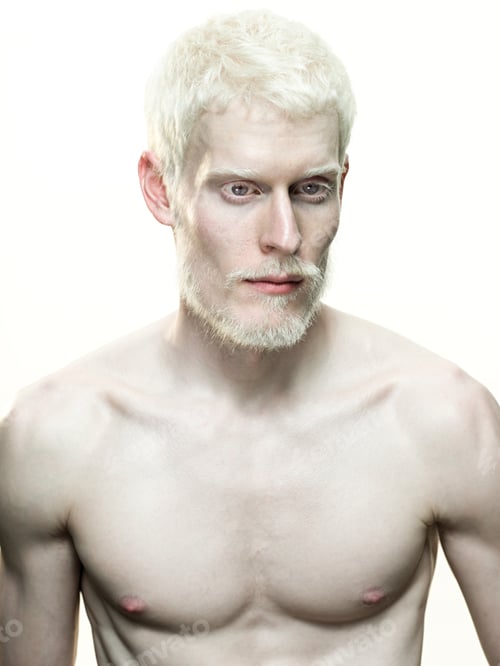 Preview: An Image Of Portrait Of An Albino Man