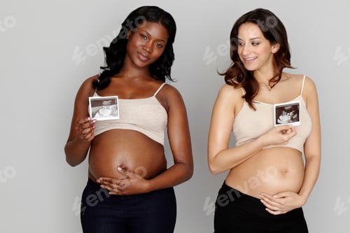 Preview: Two Pregnant Women Holding Ultrasound Scans