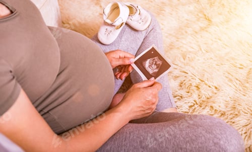 Preview: Pregnant Woman Holding Ultrasound Image. Concept Of Pregnancy, Health Care, Gynecology, Medicine