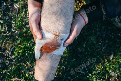 Preview: Man Is Putting Bandage On Bleeding Wound. Injured Leg. Tourist In The Nature. Infection Danger