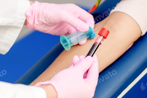 Preview: Nurse Taking Blood Sample From Patient For Analysis Of Coronavirus.